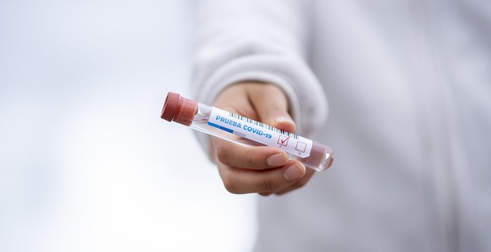 COVID-19 situacija kviečia būti atsargius, saugoti save ir artimus