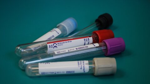 Gyventojai kviečiami nemokamai pasitikrinti gliukozės ir cholesterolio kiekį kraujyje